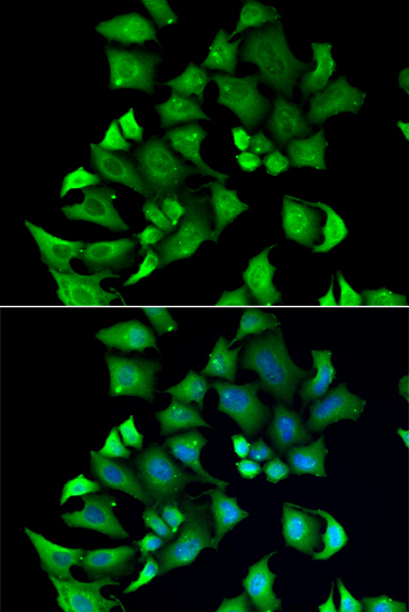 Rabbit anti-ENTPD2 Polyclonal Antibody