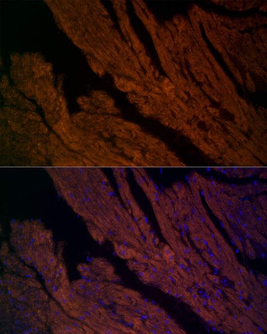 Rabbit anti-RYR2 Polyclonal Antibody
