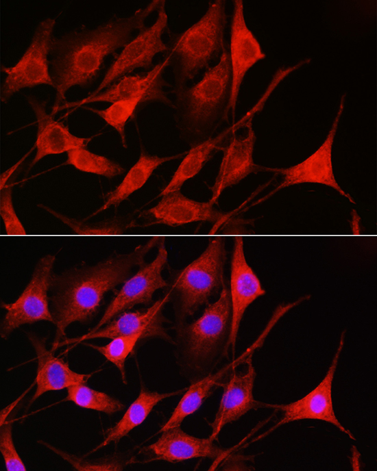 Rabbit anti-RAC1/2/3 Polyclonal Antibody