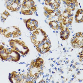 Rabbit anti-RIPK4 Polyclonal Antibody