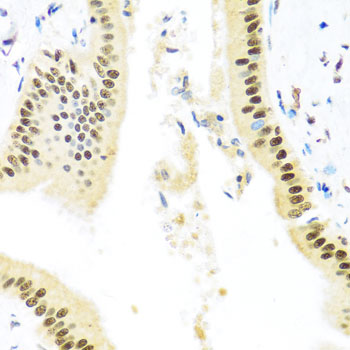 Rabbit anti-ZBTB17 Polyclonal Antibody