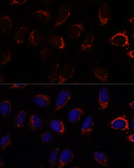 Rabbit anti-AP3S2 Polyclonal Antibody