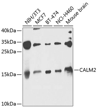 Rabbit anti-CALM2 Polyclonal Antibody