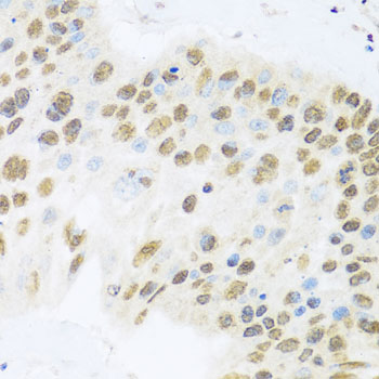 Rabbit anti-ZBTB17 Polyclonal Antibody
