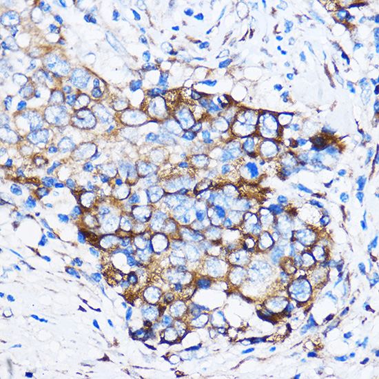 Rabbit anti-CHEK1 Polyclonal Antibody