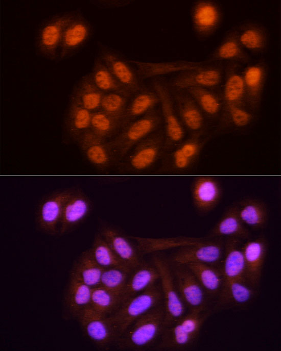 Rabbit anti-KPNA3 Polyclonal Antibody
