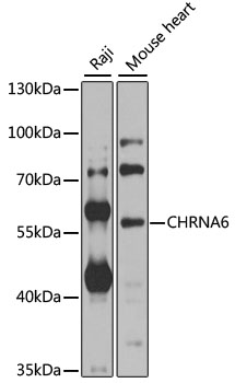 Rabbit anti-CHRNA6 Polyclonal Antibody