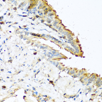 Rabbit anti-RNASE13 Polyclonal Antibody