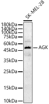 Rabbit anti-AGK Polyclonal Antibody