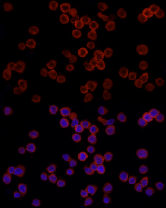 Rabbit anti-ITGAM Polyclonal Antibody