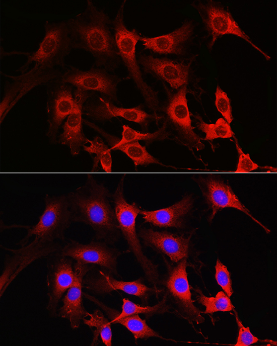 Rabbit anti-RAC1/2/3 Polyclonal Antibody
