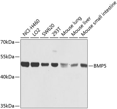 Rabbit anti-BMP5 Polyclonal Antibody