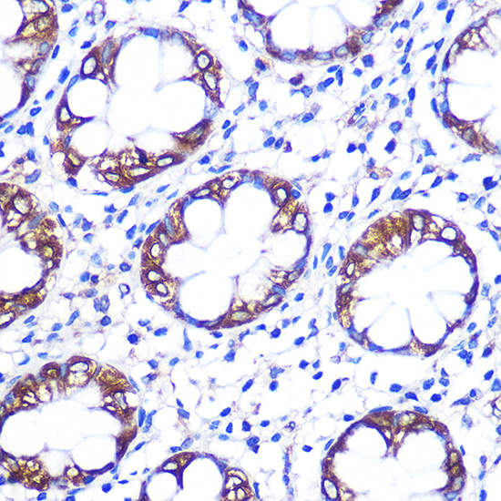 Rabbit anti-SLC6A4 Polyclonal Antibody
