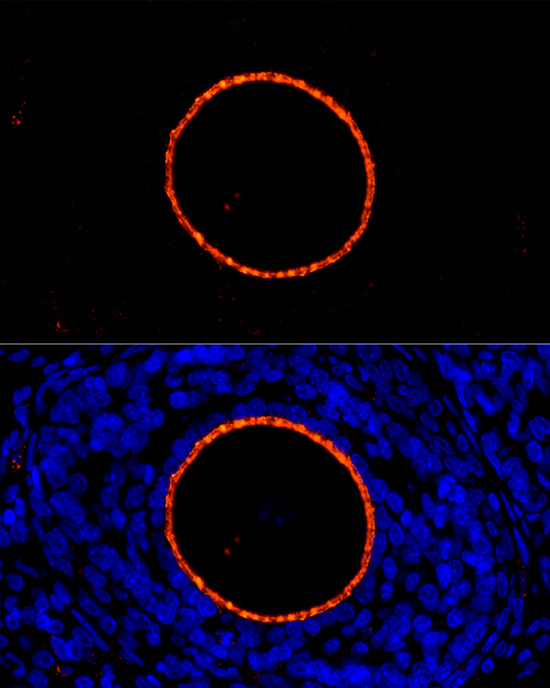 Rabbit anti-ZP2 Polyclonal Antibody