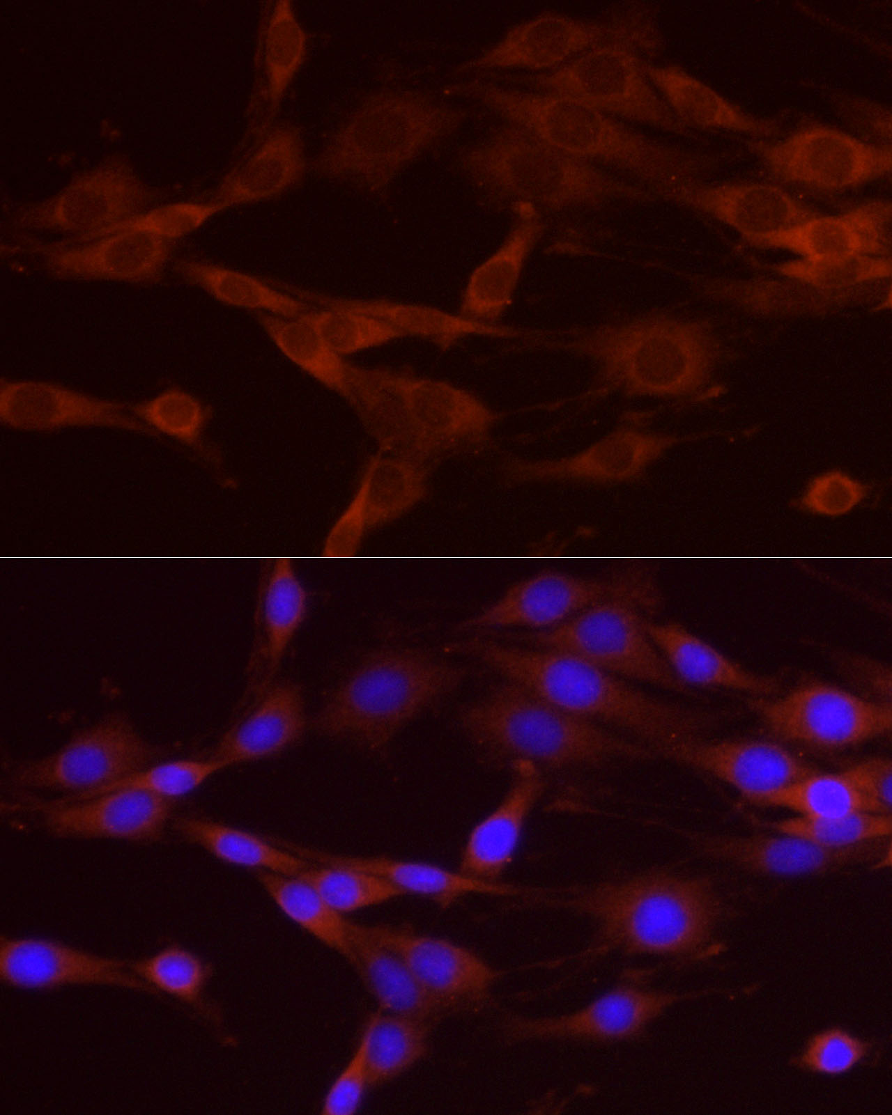 Rabbit anti-NUMB Polyclonal Antibody