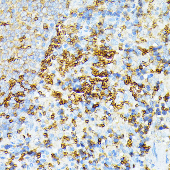 Rabbit anti-SPTA1 Polyclonal Antibody