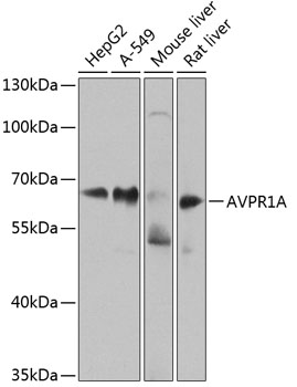 Rabbit anti-AVPR1A Polyclonal Antibody