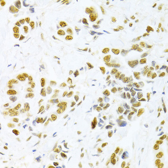 Rabbit anti-HMGB1 Polyclonal Antibody