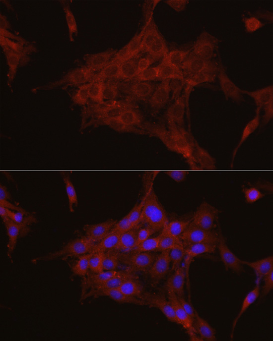 Rabbit anti-TGFBI Polyclonal Antibody