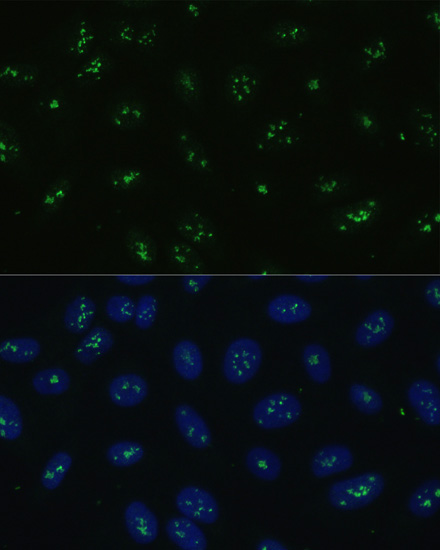 Rabbit anti-NOLC1 Polyclonal Antibody