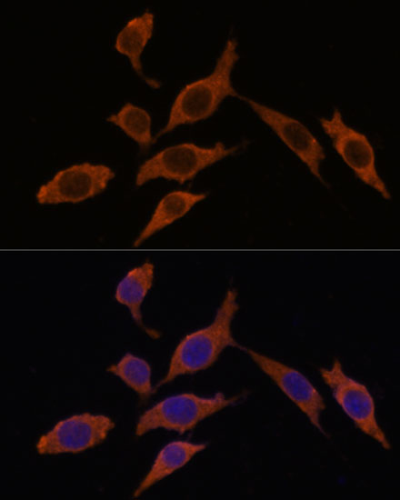 Rabbit anti-INMT Polyclonal Antibody