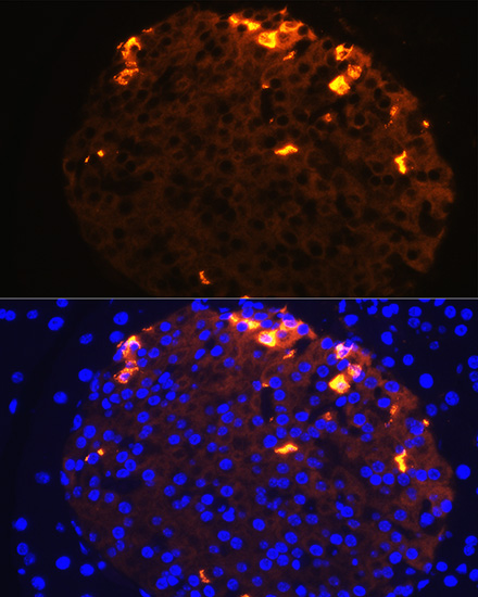 Rabbit anti-SST Polyclonal Antibody