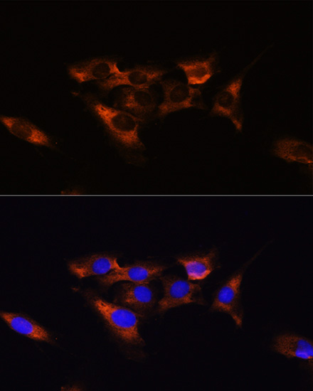 Rabbit anti-ADORA2A Polyclonal Antibody