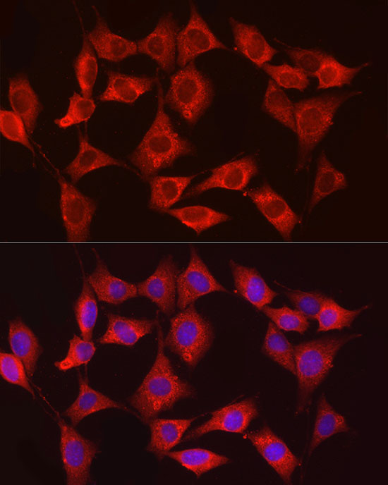 Rabbit anti-HK3 Polyclonal Antibody