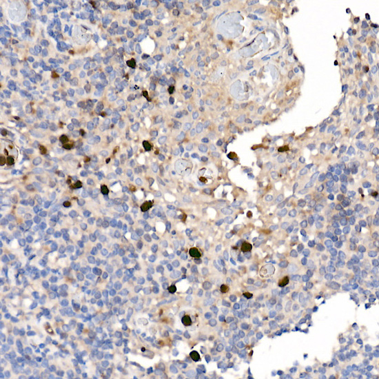 Rabbit anti-S100A12 Polyclonal Antibody