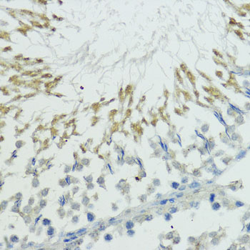 Rabbit anti-TRIP12 Polyclonal Antibody
