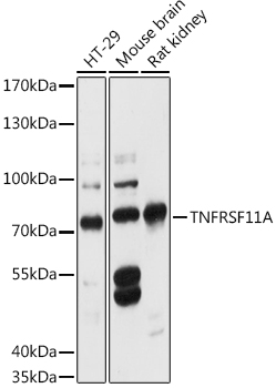 Rabbit anti-TNFRSF11A Polyclonal Antibody