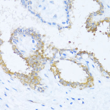 Rabbit anti-NAT2 Polyclonal Antibody