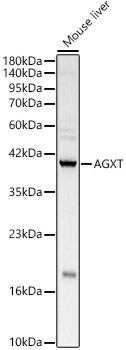 Rabbit anti-AGXT Polyclonal Antibody