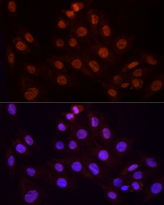 Rabbit anti-KPNA3 Polyclonal Antibody