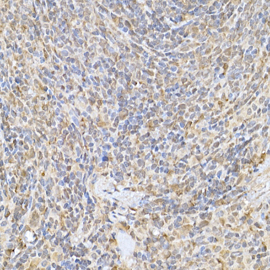 Rabbit anti-SOCS1 Polyclonal Antibody