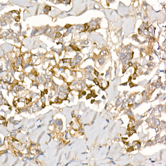 Rabbit anti-TGFBI Polyclonal Antibody