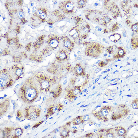 Rabbit anti-AGXT Polyclonal Antibody