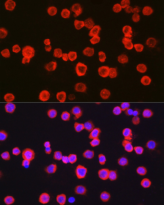 Rabbit anti-ITGAM Polyclonal Antibody