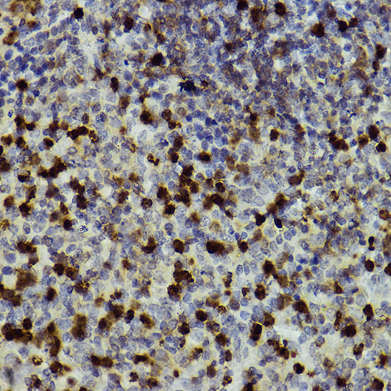 Rabbit anti-ITGAM Polyclonal Antibody