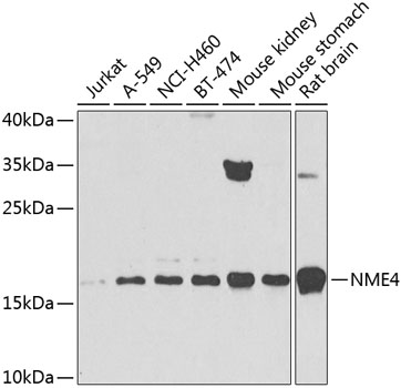 Rabbit anti-NME4 Polyclonal Antibody