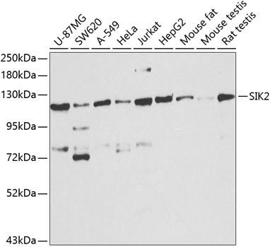 Rabbit anti-SIK2 Polyclonal Antibody