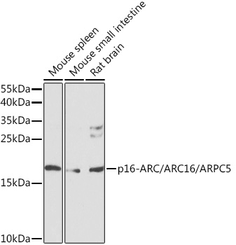 Rabbit anti-ARPC5 Polyclonal Antibody
