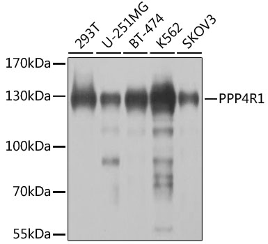 Rabbit anti-PPP4R1 Polyclonal Antibody