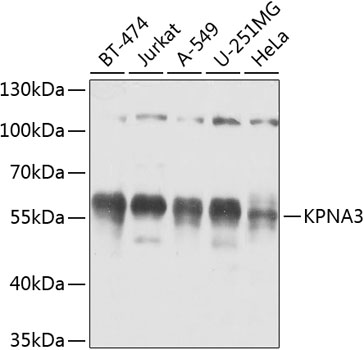 Rabbit anti-KPNA3 Polyclonal Antibody