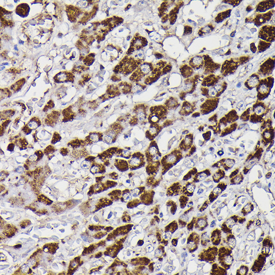 Rabbit anti-MAOB Polyclonal Antibody