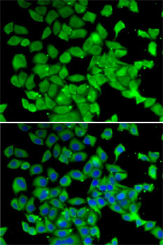 Rabbit anti-PARN Polyclonal Antibody
