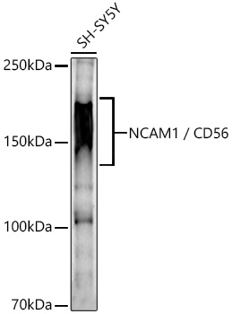 Rabbit anti-NCAM1 Polyclonal Antibody