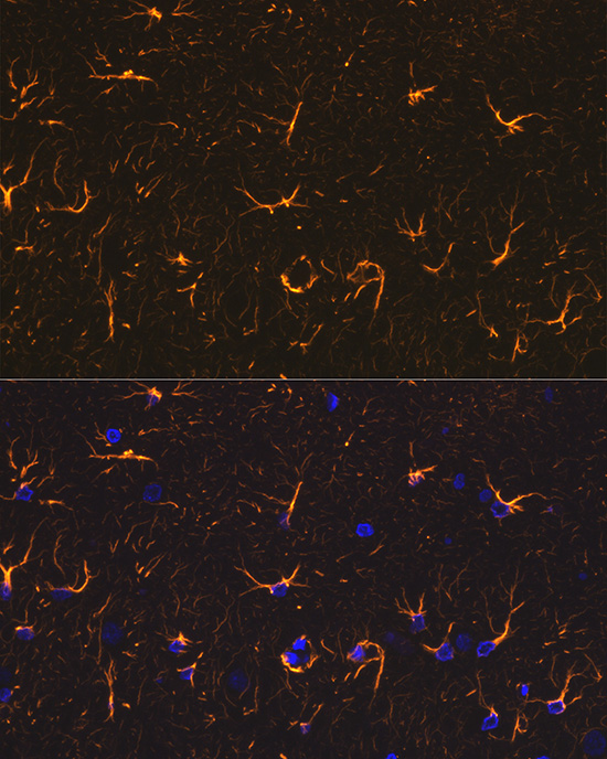 Rabbit anti-GFAP Polyclonal Antibody