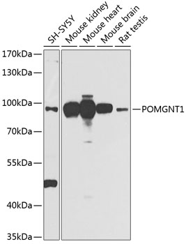 Rabbit anti-POMGNT1 Polyclonal Antibody