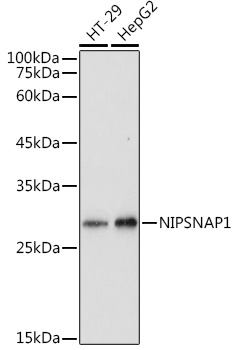 Rabbit anti-NIPSNAP1 Polyclonal Antibody